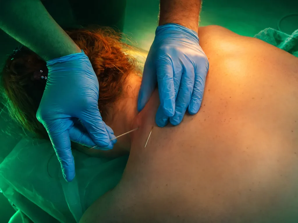 Акупунктурный лифтинг обучение