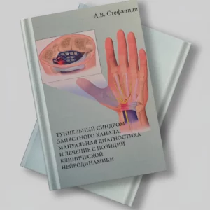 Стефаниди А.В. - «Туннельный синдром запястного канала»