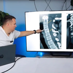 прикладная кинезиология видео обучение