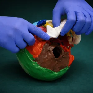 ВНЧС терапия демонстрация для слушателей вебинара